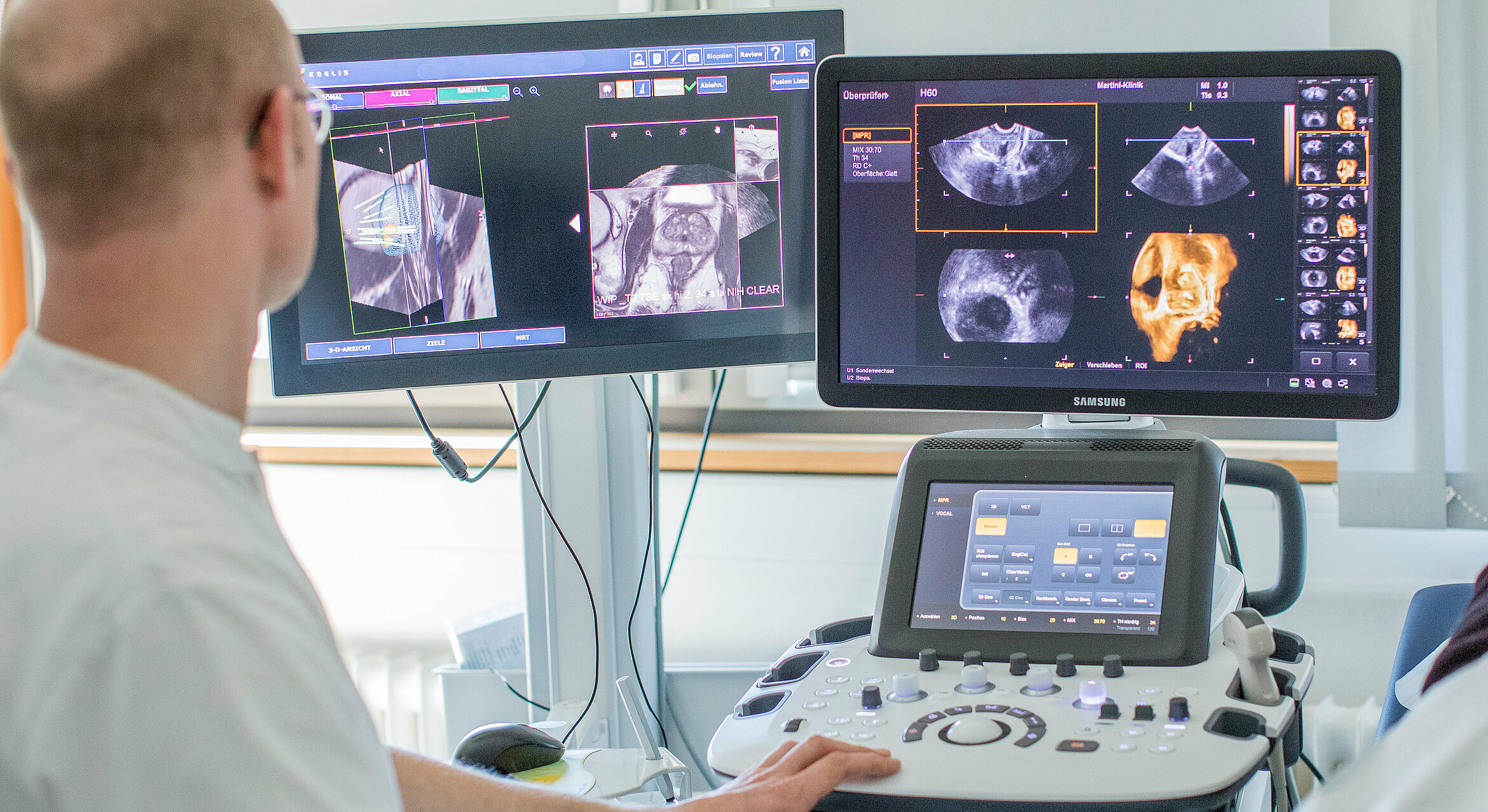 Ein Arzt sitzt vor einem Ultraschallgerät und schaut auf die Monitore